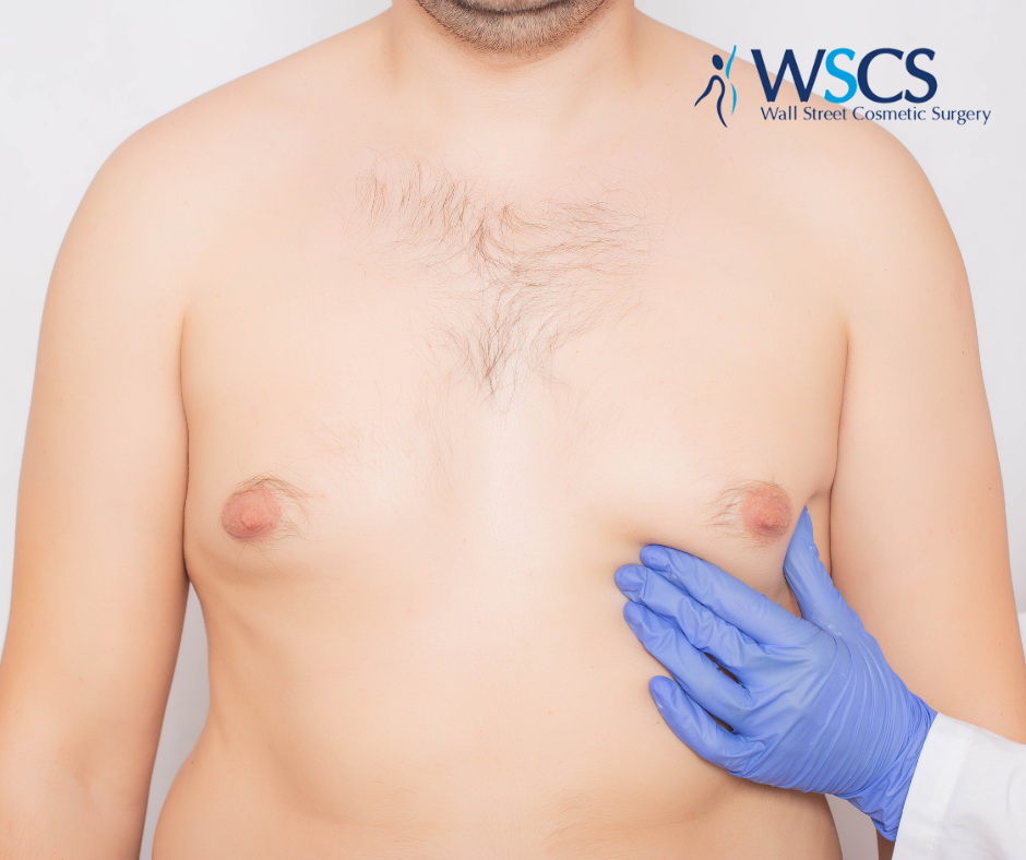 A man's body. A doctor's hand is feeling near his breast for gynecomastia